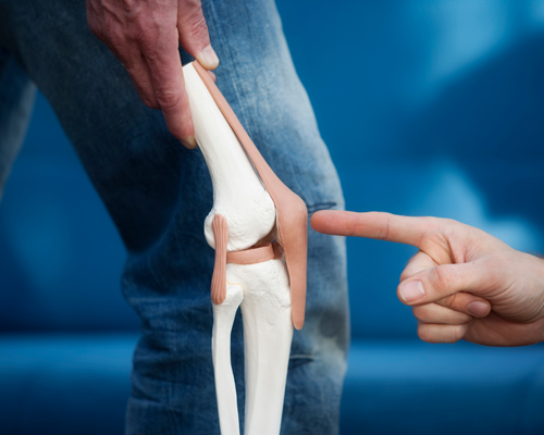 Joint Replacement Surgery